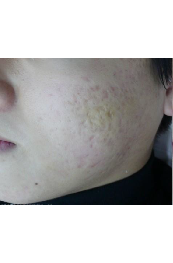 Before