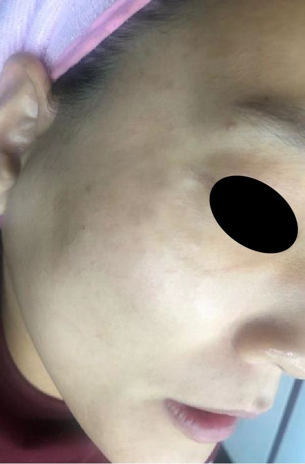 After